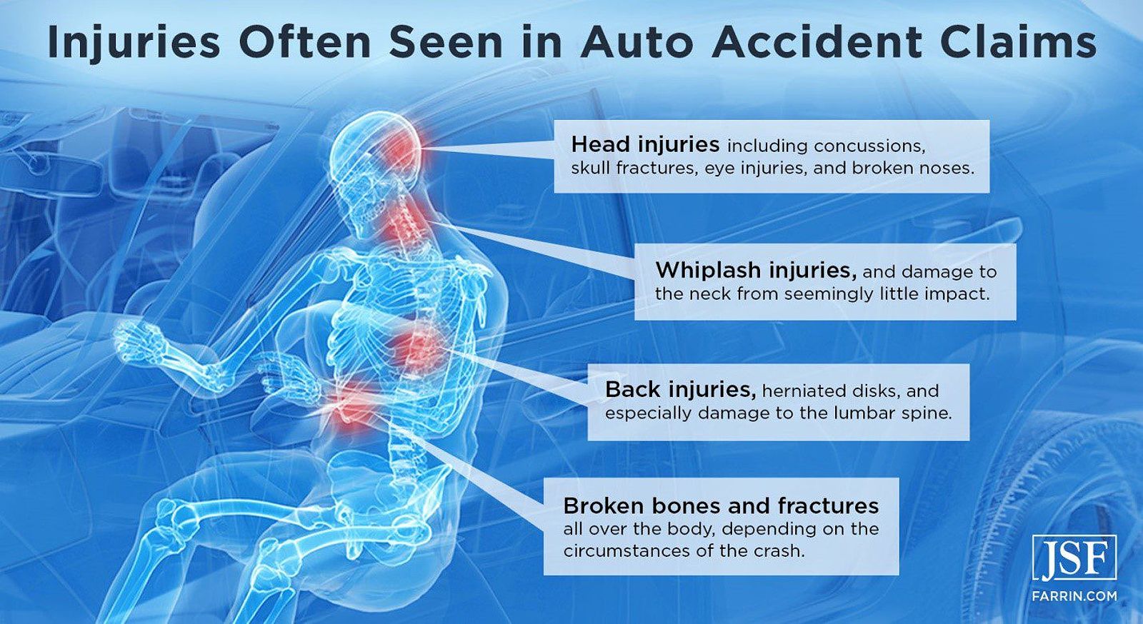 Four common injuries in car accidents